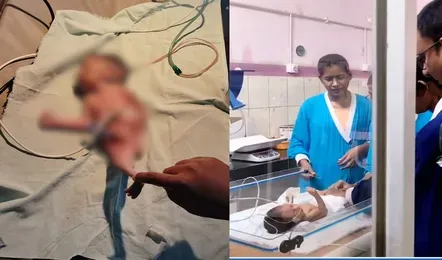  छत्तीसगढ़ के धमतरी जिले में मरमेड बेबी’ का हुआ जन्म से ही दोनों पैर जलपरी जैसे जुड़े हुए थे, तीन घंटे बाद हुई मौत